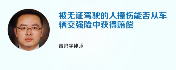 被无证驾驶的人撞伤能否从车辆交强险中获得赔偿